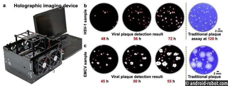 ИИ и голографическая визуализация ускоряют обнаружение вирусных бляшек